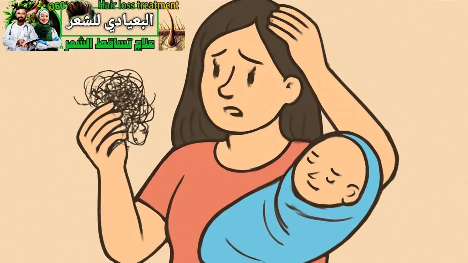 علاج تساقط الشعر بعد الولادة